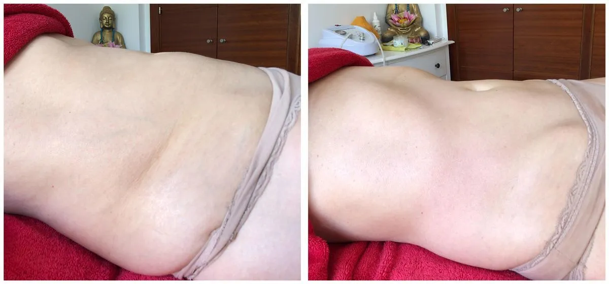 Abdominal Lymphatic Modelage